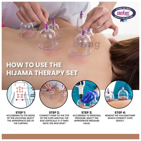 Cupping Set of 24